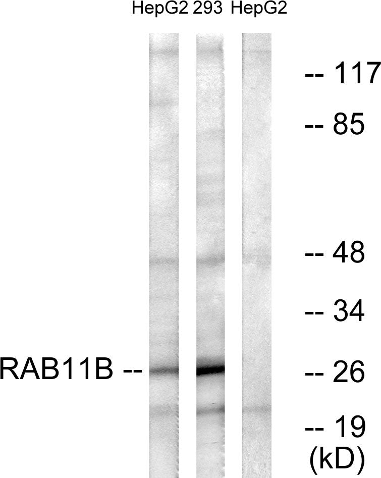 Rab 11B Rabbit Polyclonal Antibody