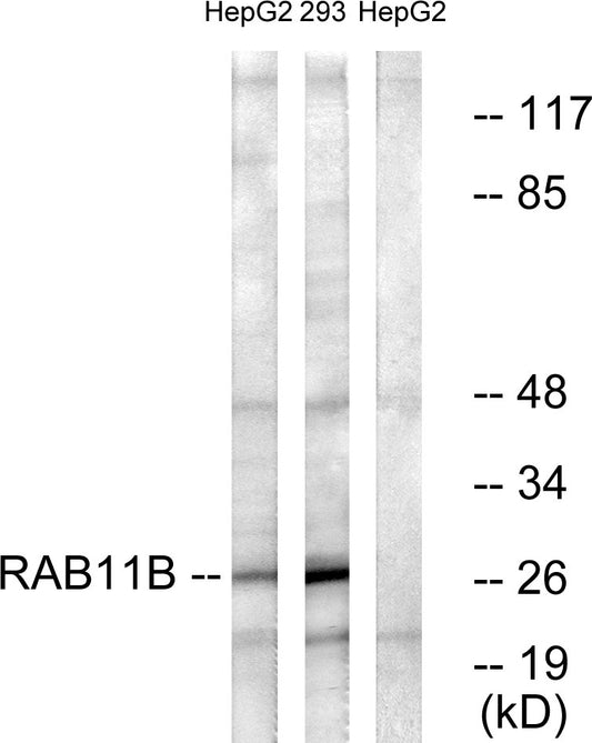 Rab 11B Rabbit Polyclonal Antibody