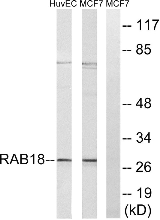 Rab 18 Rabbit Polyclonal Antibody