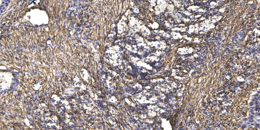 Rab 24 Rabbit Polyclonal Antibody