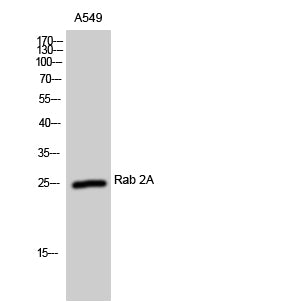 Rab 2A Rabbit Polyclonal Antibody