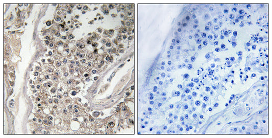 Rab 3 GAP p130 Rabbit Polyclonal Antibody
