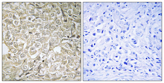 Rab 37 Rabbit Polyclonal Antibody