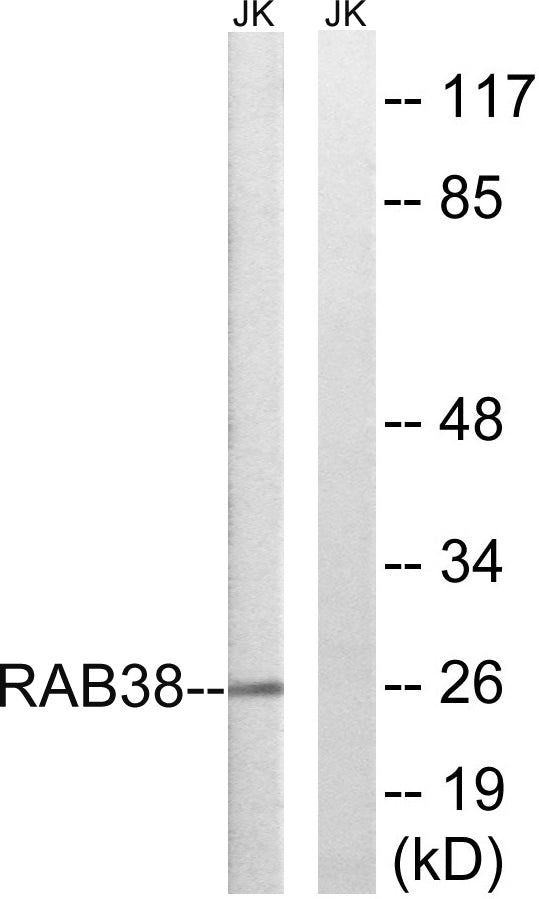 Rab 38 Rabbit Polyclonal Antibody