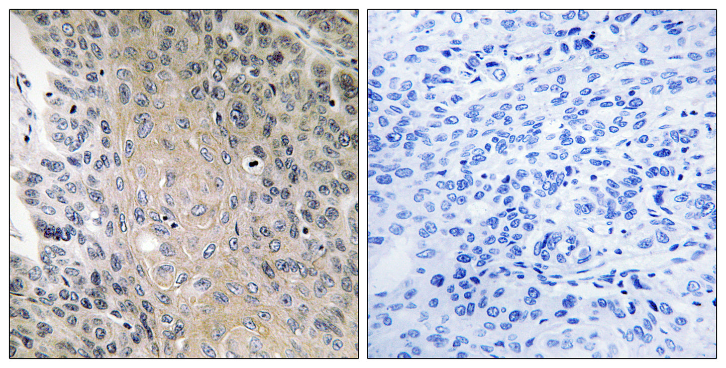 Rab 41 Rabbit Polyclonal Antibody