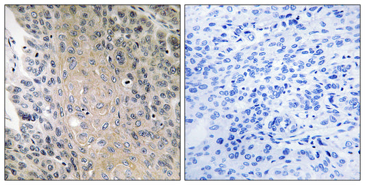 Rab 41 Rabbit Polyclonal Antibody