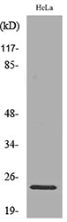 Rab 5A Rabbit Polyclonal Antibody