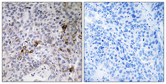 Rab11-FIP3 Rabbit Polyclonal Antibody
