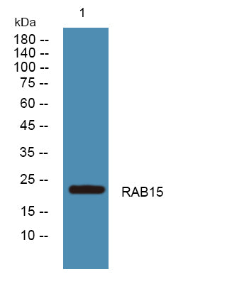 RAB15 Rabbit Polyclonal Antibody