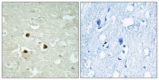 RAB3IP Rabbit Polyclonal Antibody
