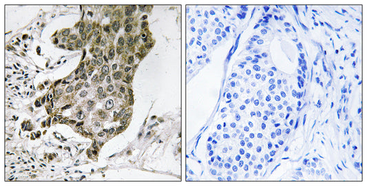 Rabaptin-5α Rabbit Polyclonal Antibody