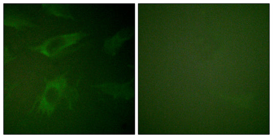 Rabphilin-3A Rabbit Polyclonal Antibody