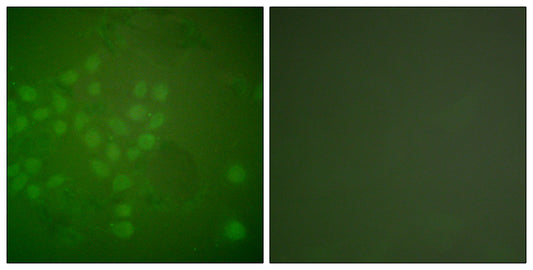 Rad17 Rabbit Polyclonal Antibody