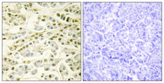 Rad51B Rabbit Polyclonal Antibody