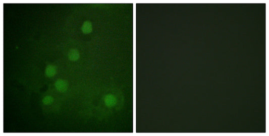 Rad52 Rabbit Polyclonal Antibody