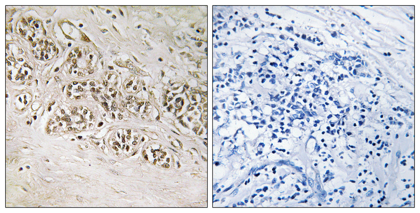 Rad54B Rabbit Polyclonal Antibody
