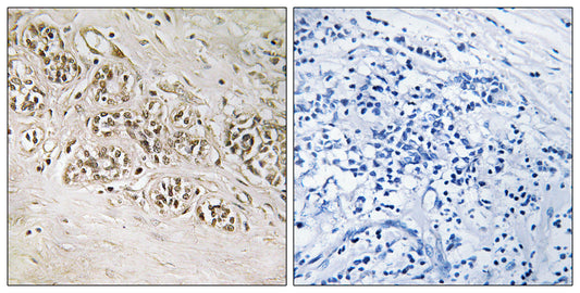 Rad54B Rabbit Polyclonal Antibody