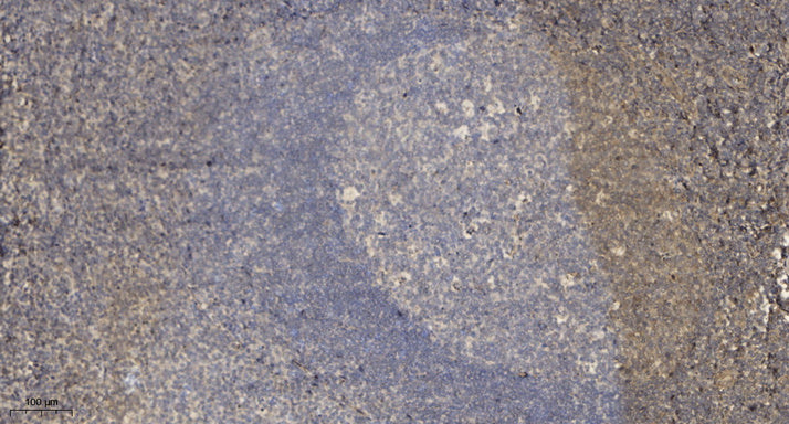 Rad9 Rabbit Polyclonal Antibody
