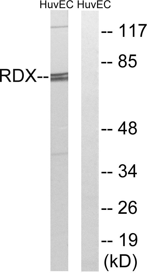 Radixin Rabbit Polyclonal Antibody
