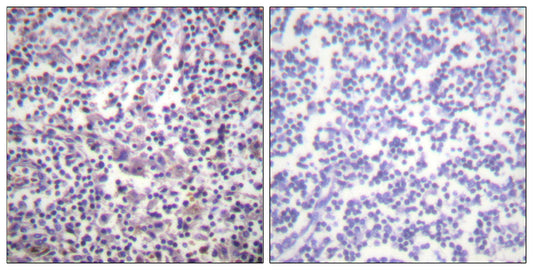 Raf-B Rabbit Polyclonal Antibody
