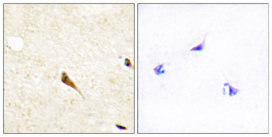 RAGE Rabbit Polyclonal Antibody