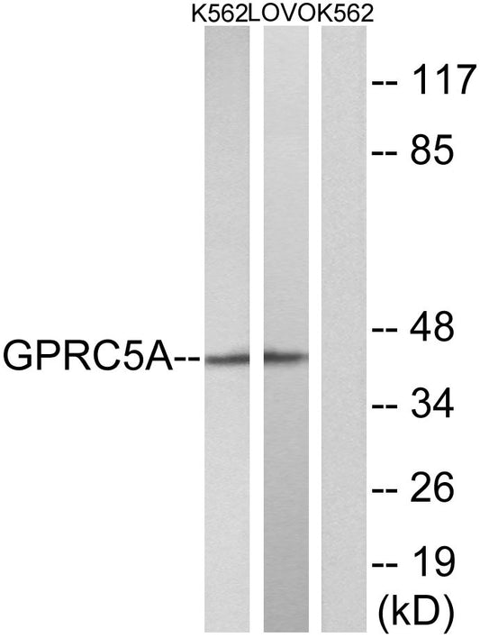 RAI3 Rabbit Polyclonal Antibody