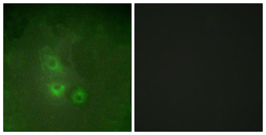 Rak Rabbit Polyclonal Antibody