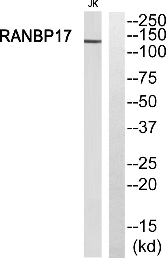 Ran BP-17 Rabbit Polyclonal Antibody