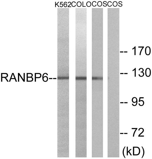 Ran BP-6 Rabbit Polyclonal Antibody