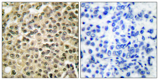 Ran Rabbit Polyclonal Antibody