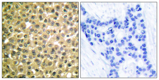 RARβ Rabbit Polyclonal Antibody