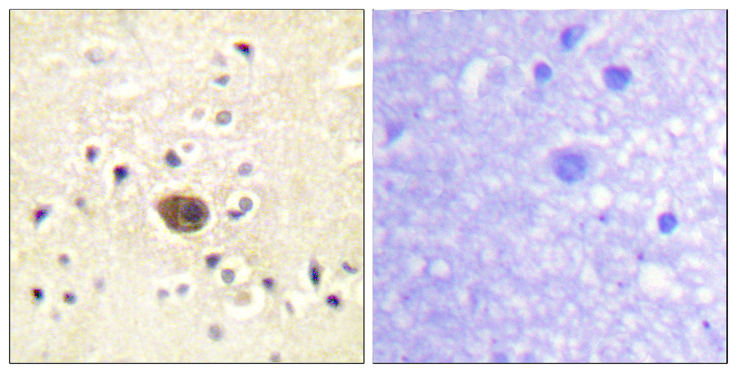 Ras-GRF1 Rabbit Polyclonal Antibody