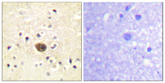 Ras-GRF1 Rabbit Polyclonal Antibody