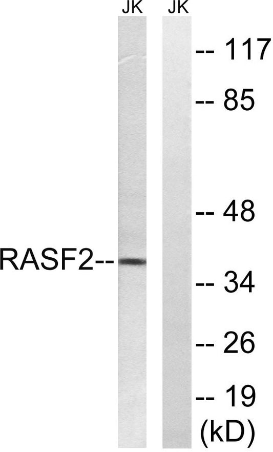 RASSF2 Rabbit Polyclonal Antibody
