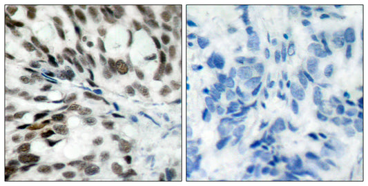 Rb Rabbit Polyclonal Antibody