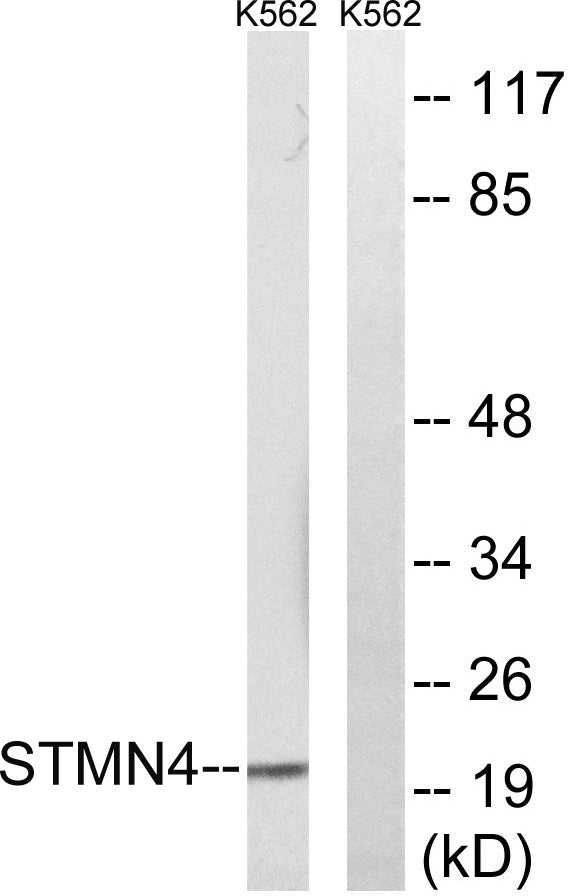 RB3 Rabbit Polyclonal Antibody