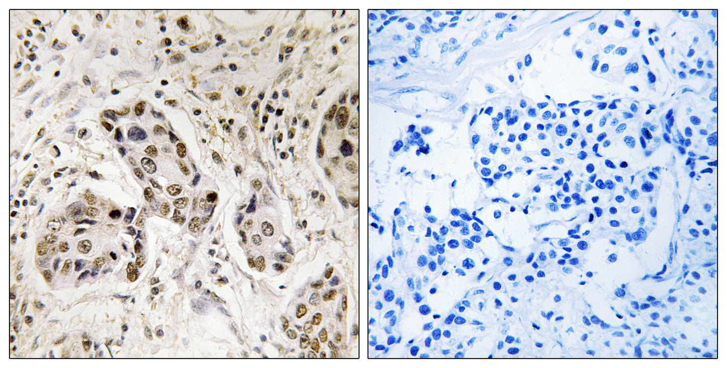 RCC2 Rabbit Polyclonal Antibody