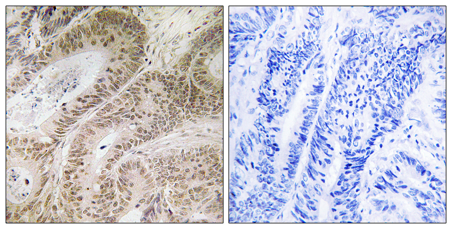 RDM1 Rabbit Polyclonal Antibody