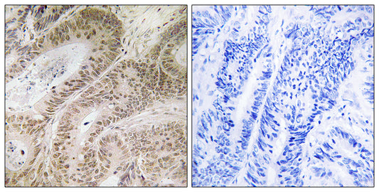 RDM1 Rabbit Polyclonal Antibody