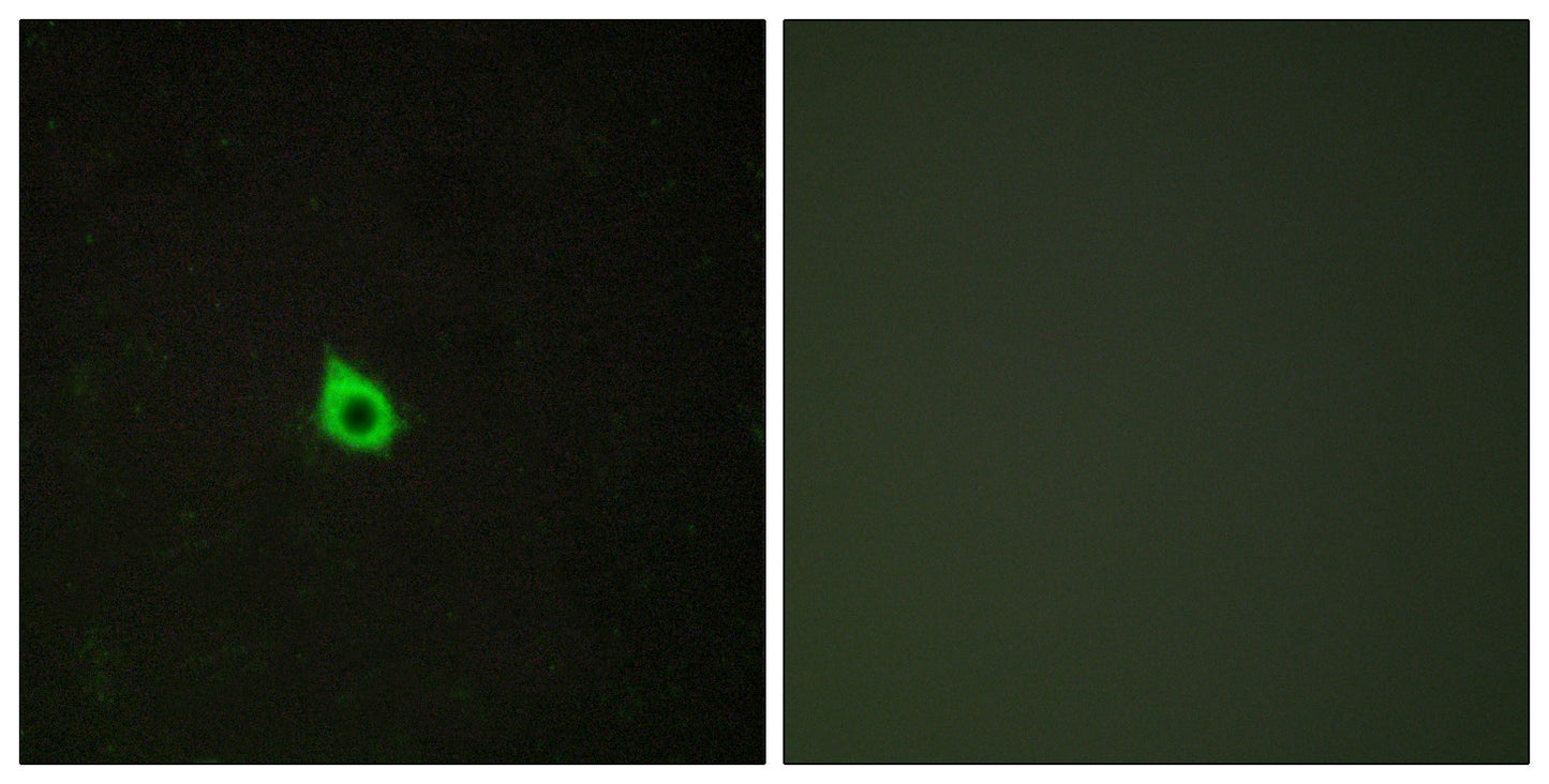 RECK Rabbit Polyclonal Antibody