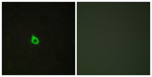 RECK Rabbit Polyclonal Antibody