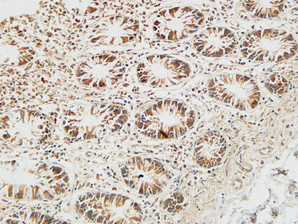 Reg IV Rabbit Polyclonal Antibody
