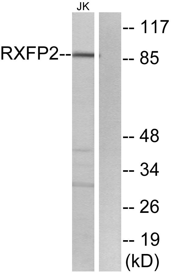 Relaxin Receptor 2 Rabbit Polyclonal Antibody