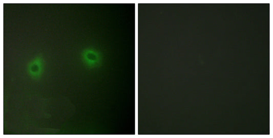 Renin Receptor Rabbit Polyclonal Antibody