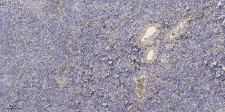 Resistin Rabbit Polyclonal Antibody
