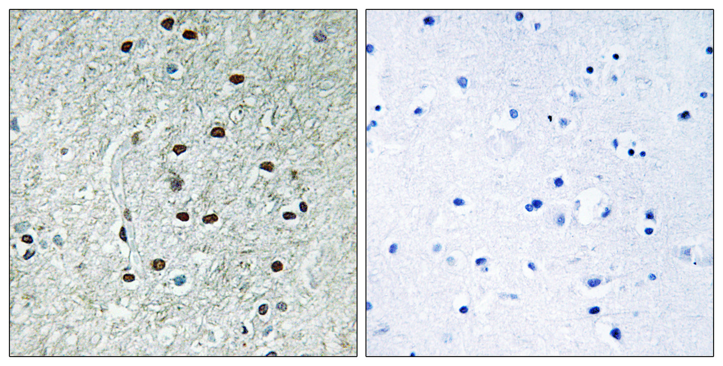 REXO1 Rabbit Polyclonal Antibody