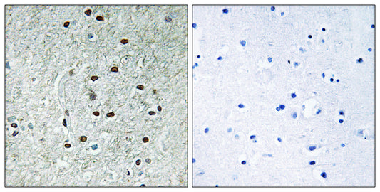 REXO1 Rabbit Polyclonal Antibody