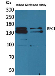 RFC1 Rabbit Polyclonal Antibody