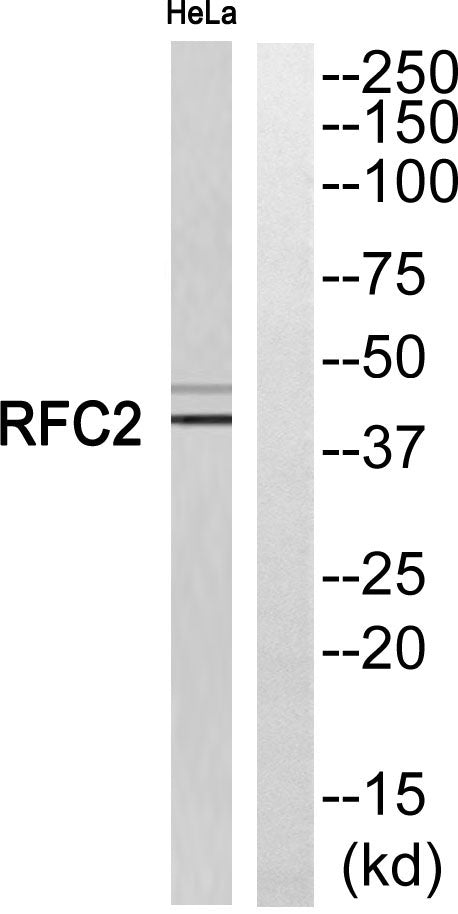 RFC2 Rabbit Polyclonal Antibody