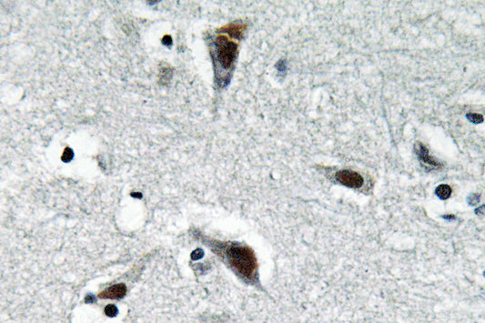 RFC3 Rabbit Polyclonal Antibody